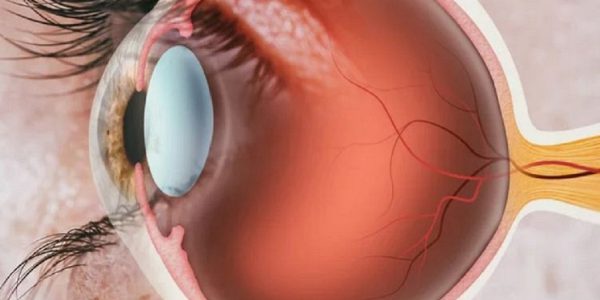 3-thuy-tinh-the-shutterstock-168